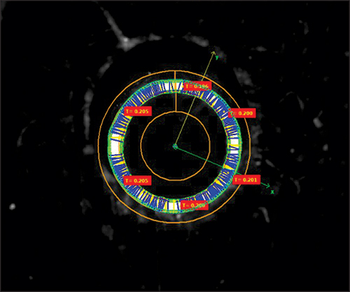 High - Resolution Cable Analysis